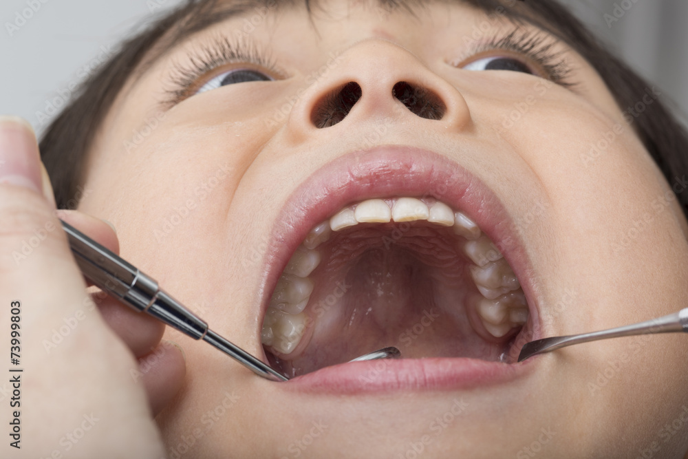 Children undergoing dental checkup
