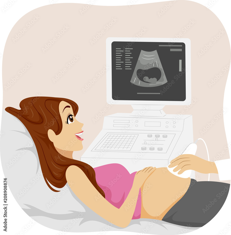 少女怀孕超声波插图