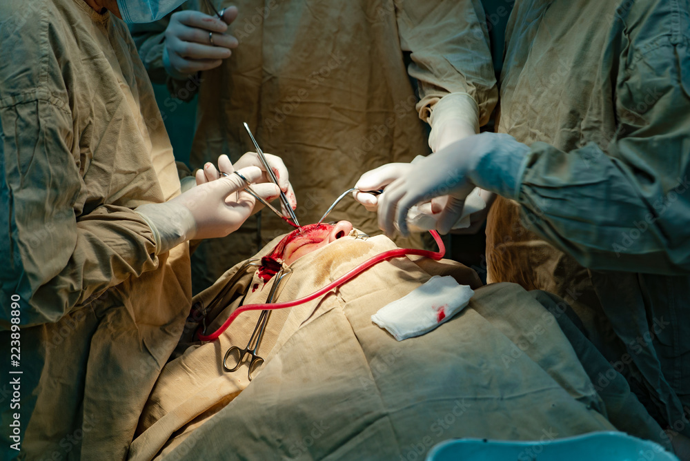 外科医生在医院里借助医疗器械对一名男子的面部进行手术。