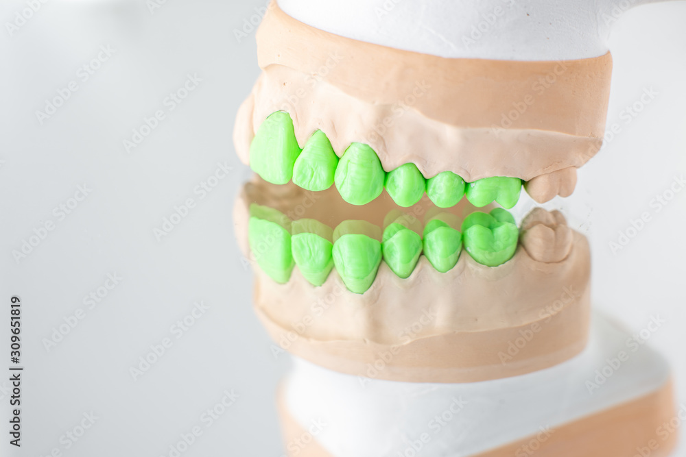 背景为绿色的假牙石膏模型特写。Co