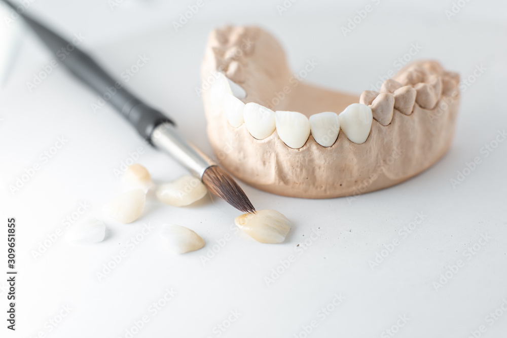 白色背景上有牙齿和画笔的人工颌石膏模型特写。Conce