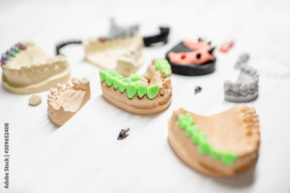 白色背景上有种植牙和牙冠的各种人工下颌模型。概念