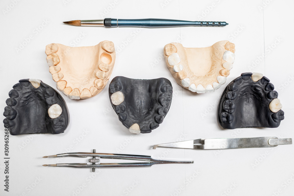 白色背景上带有牙科植入物和仪器的人造石膏颌模型，俯视图