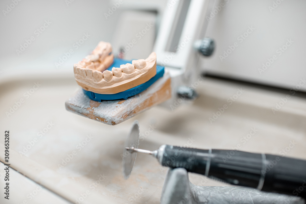 在牙科技术人员的工作场所用一套牙套进行种植体建模的人工颌