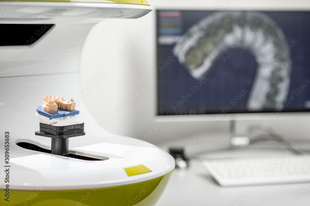Scanning jaw model on the 3rd scanner in the laboratory, for the manufacture of dentures or implants