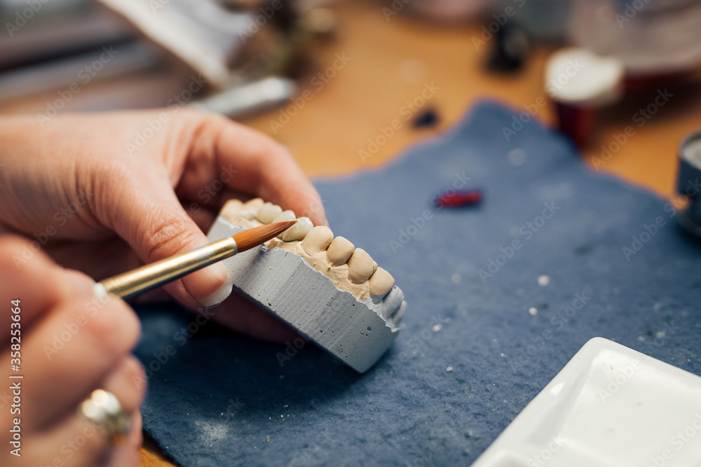 Dental technician working on prosthesis,close-up.