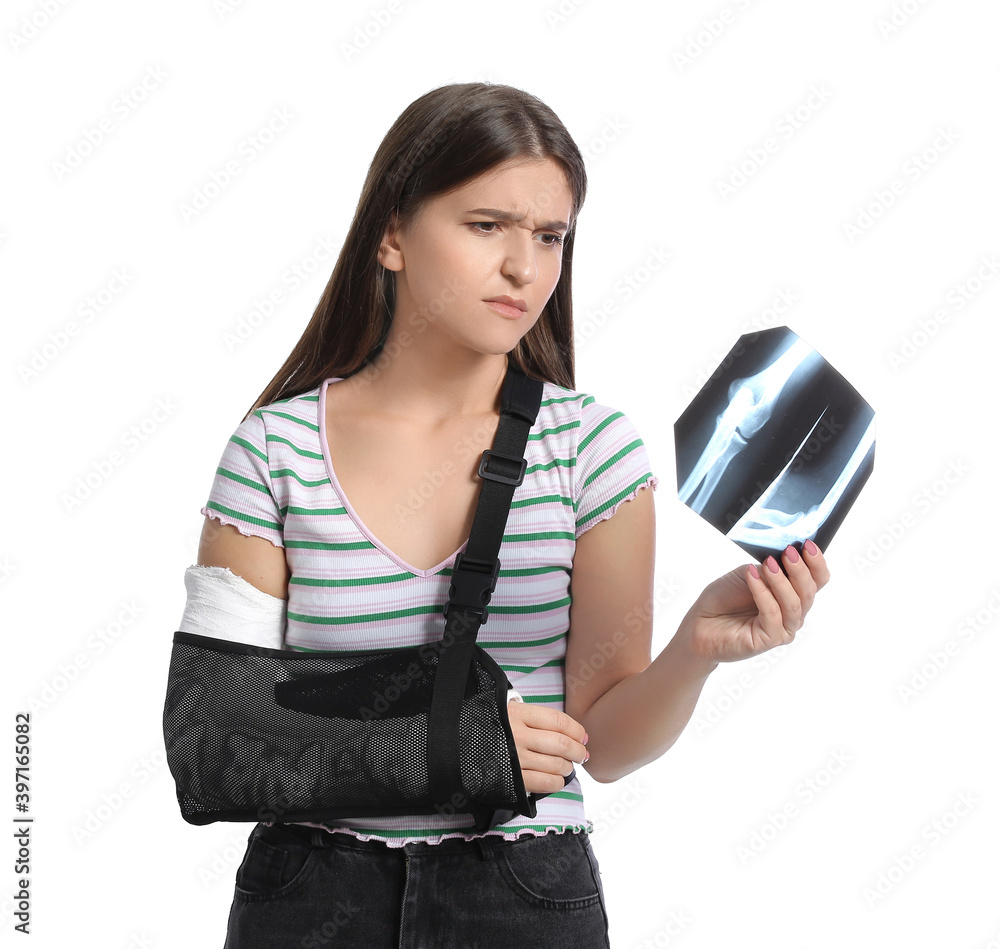 年轻女子手臂骨折，拿着白色背景的x光照片