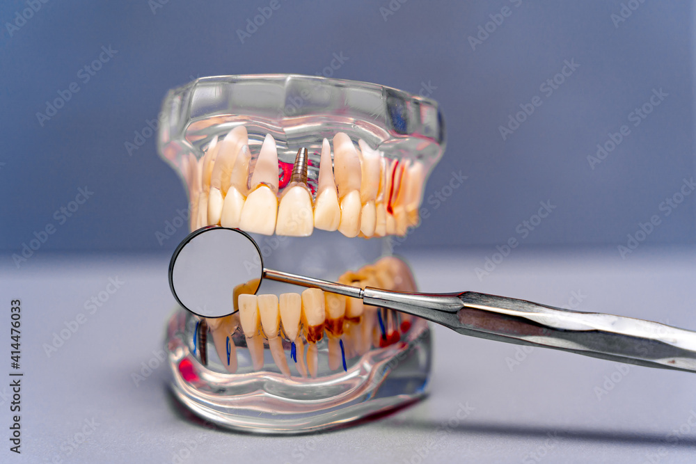 牙科和颌面外科中用于假肢的颌骨塑料模型躺在一个白色的桌子上