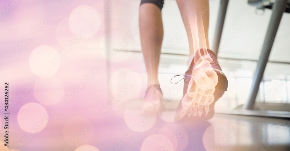女性在跑步机上跑步，腿骨可见，有光点