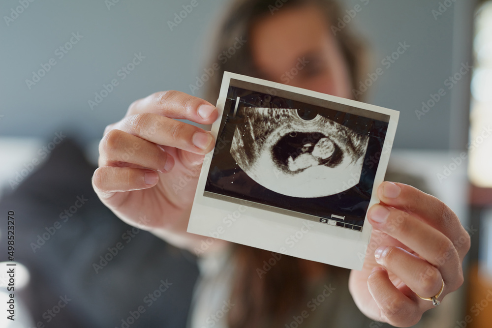 看看我的小花生。一个女人拿着她未出生婴儿的超声波照片。