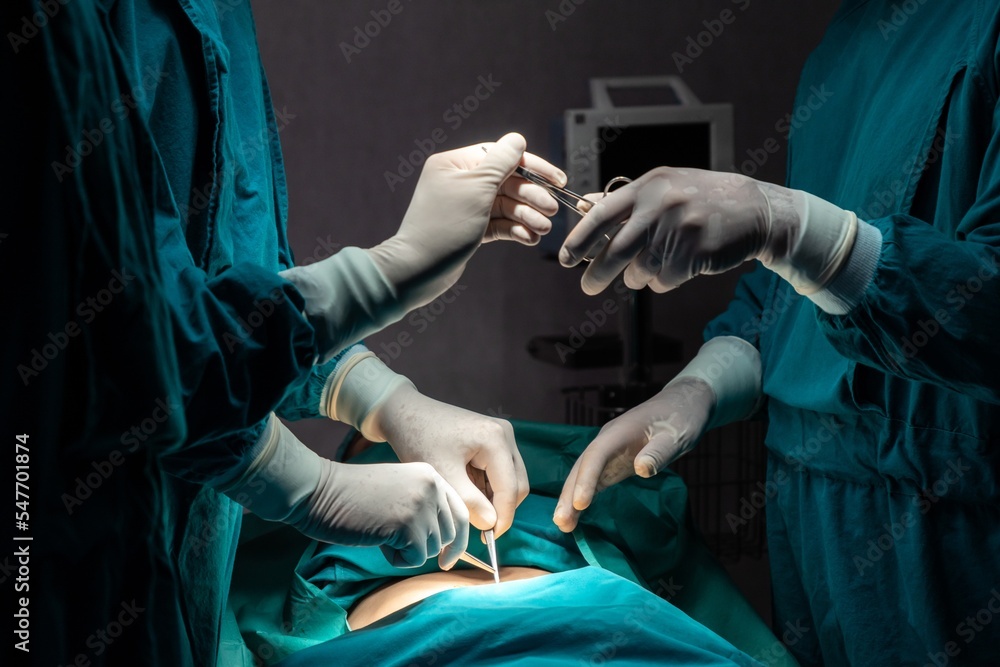 Image of surgical team perform surgery operation, nurse hand out sterile scissors to surgeon as supp